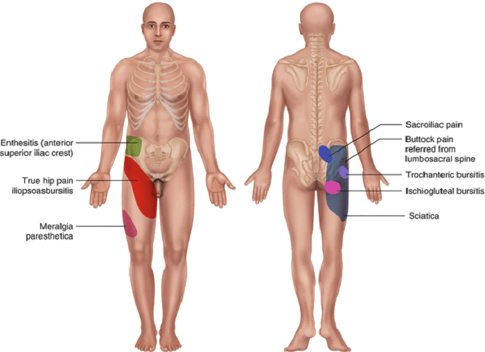 Introduction to Sports Hernia